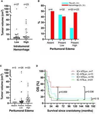 Brain Tumor Microenvironment and Angiogenesis in Melanoma Brain Metastases